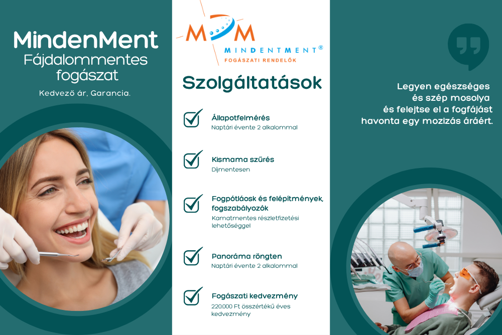 elszöv_mindenment